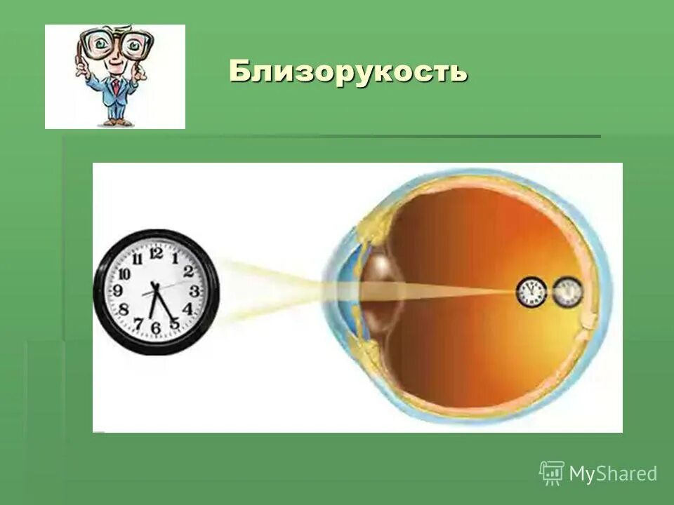 Презентация глаз как оптическая система 9 класс