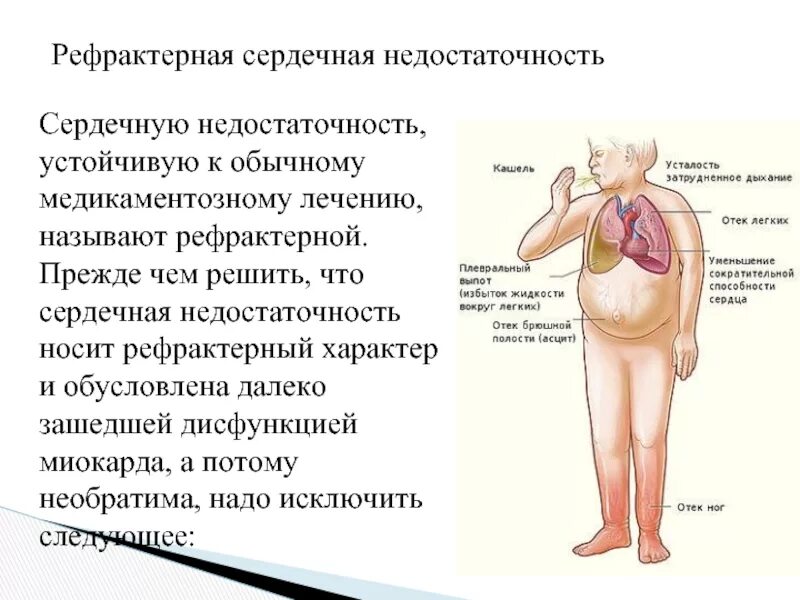 Асцит при сердечной недостаточности. Рефрактерный отечный синдром при ХСН. Симптомы сердечной недостаточности. Внешний вид при сердечной недостаточности. Сердечная недостаточность обусловлена