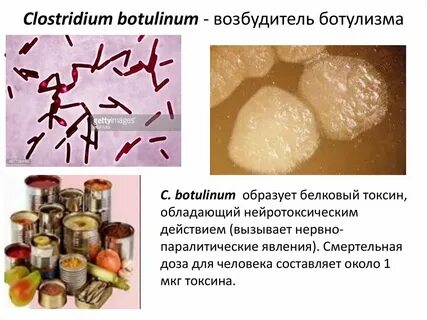 Токсины возбудителей