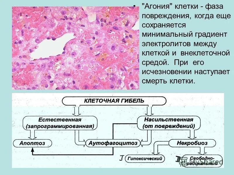 Тест повреждение клетки. Повреждение клетки. Некроз клетки схема. Стадии повреждения клетки. Обратимые и необратимые повреждения клетки некроз апоптоз.