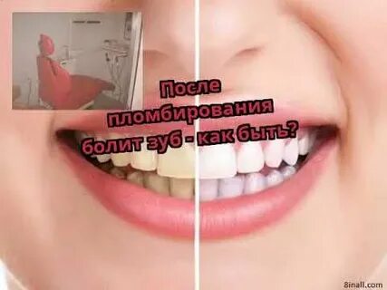 Через сколько можно пить после пломбы установки
