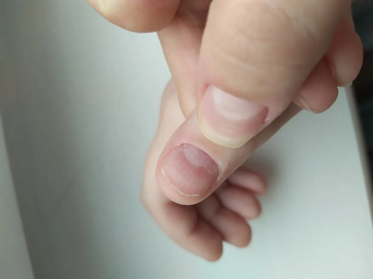 Пятно на ногте указательного пальца