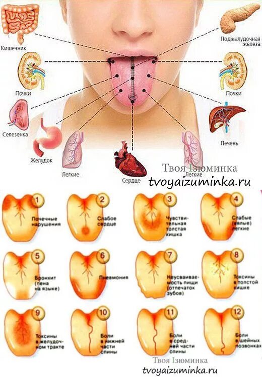 Как определить больной орган. Налет на языке о чем говорит таблица цвет фото. Язык налет желтоватого цвета у ребенка. Заболевания по цвету языка. Распознать болезнь по языку.