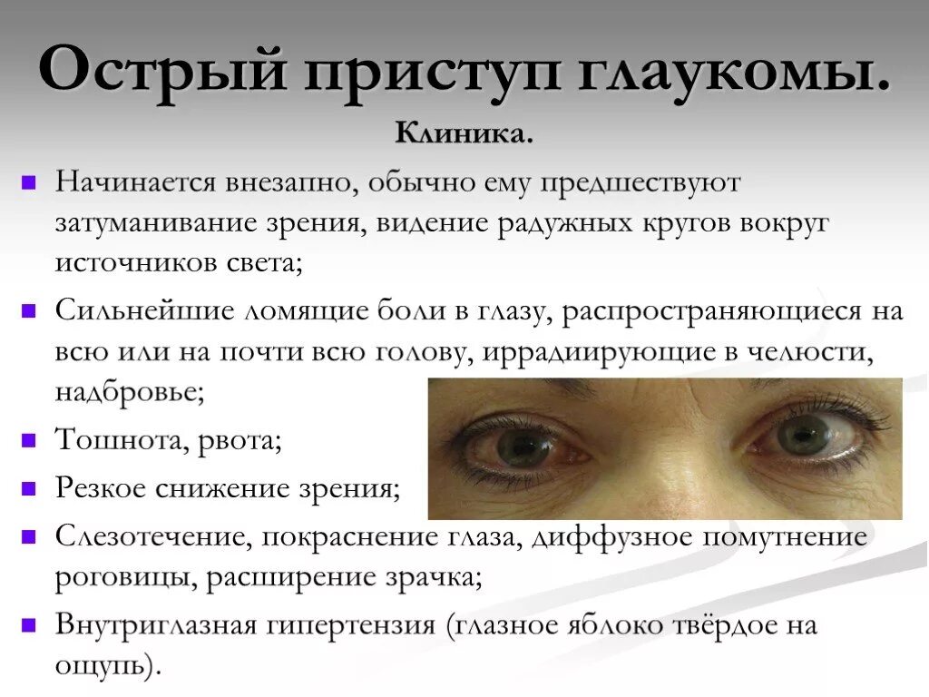 Глаза давление сильное. Острый приступ глаукомы клиника. Симптомы острого приступа закрытоугольной глаукомы. Острый приступ закрытоугольной глаукомы клиника. Отстрвй присьуп гдаукоиаю.