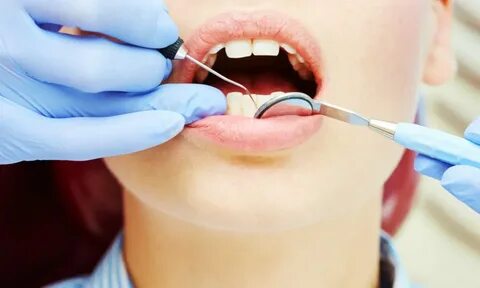 Restorative Dentistry in San Antonio