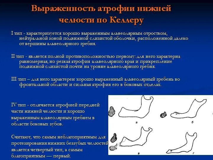 классификация атрофии челюстей. пример аторыии от давления. классификация атрофии альвеолярного отростка нижней челюсти. атрофия зрительного нерва лебера. атрофия зубной кости нижней челюсти.
