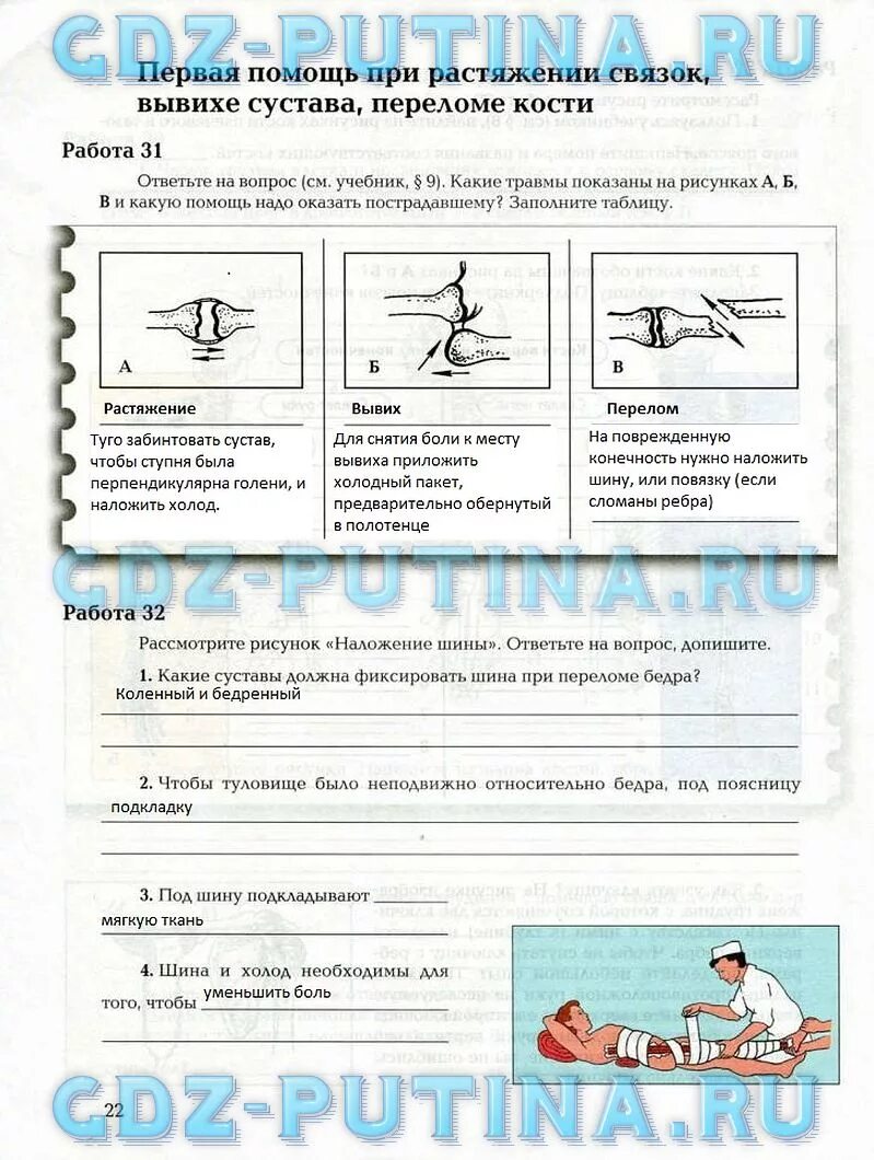 Какая травма изображена на рисунке. На рентгеновском снимке изображен сустав. На рисунке изображена травма которая называется. Вывих картинки для презентации. Передне-нижний вывих плечевой кости.