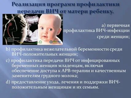 Профилактика вич инфекции в детской больнице