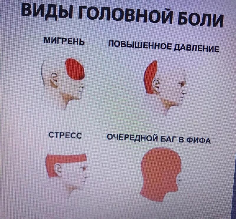 Утром болит голова причины. Болит голова. Типы головной боли. Болит голова при высоком давлении. Затылочная головная боль.