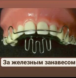 Упор для языка