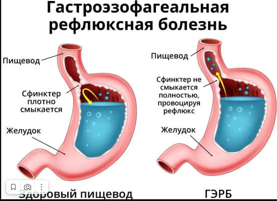 Грэб
