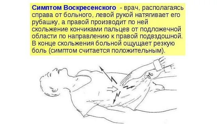 Аппендицит блюмберга симптомы. Симптомы воскресенского щеткина-блюмберга ровзинга ситковского. симптом воскресенского рубашки. симптом воскресенского и ситковского. симптом воскресенского острый аппендицит.