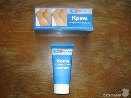 Чем мазать сухие