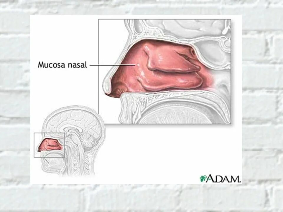 Воспаление слизистой оболочки носовых ходов. Слизистая оболочка носа. Слизистые оболочки носа. Острый катаральный ринит