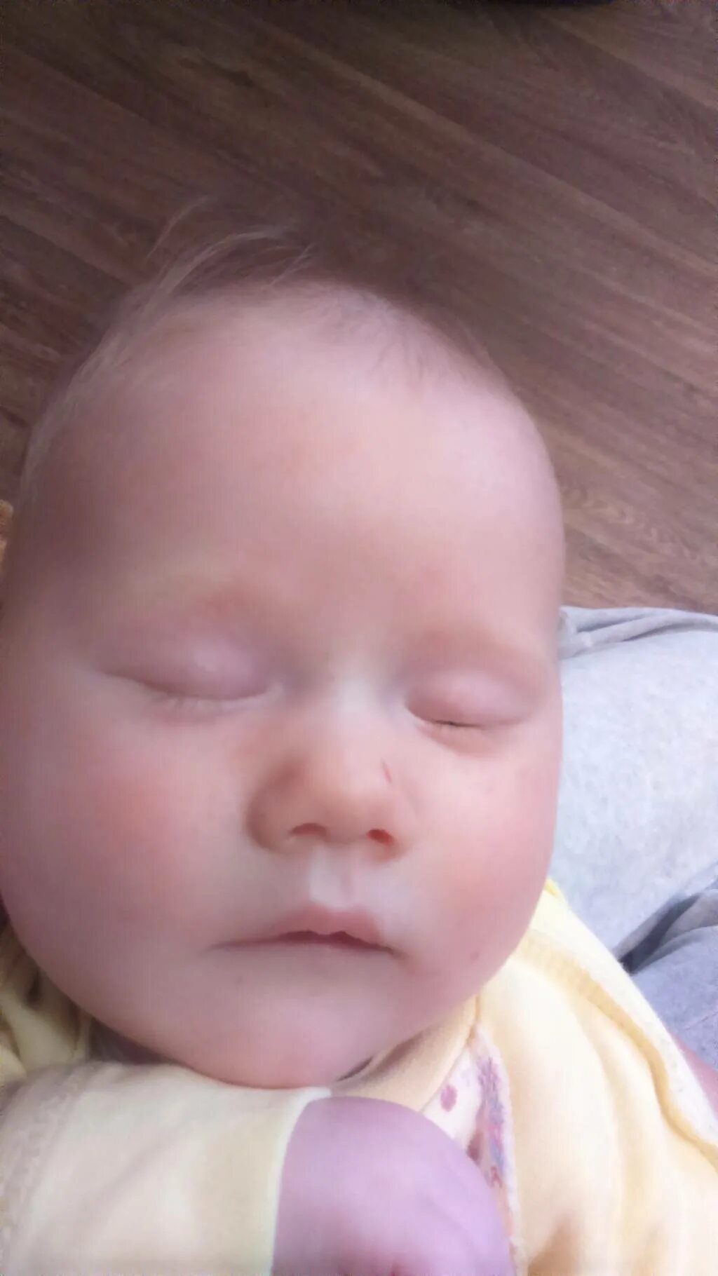 Носогубный треугольник цианоз. Цианоз кожи у новорожденного. Синюшность на лице грудничка. Синюшность носогубного треугольника.