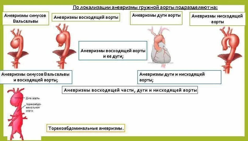 Аневризма аорты какие операции. Аневризмы восходящего отдела аорты классификация. аневризма восходящего отдела аорты классификация. расслаивающая аневризма восходящего отдела аорты. аневризма восходящего отдела аорты клиника.