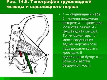Седалищная точка