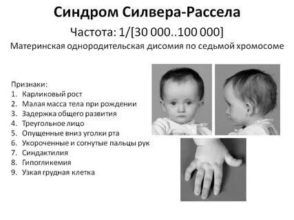 Синдром барбера сея