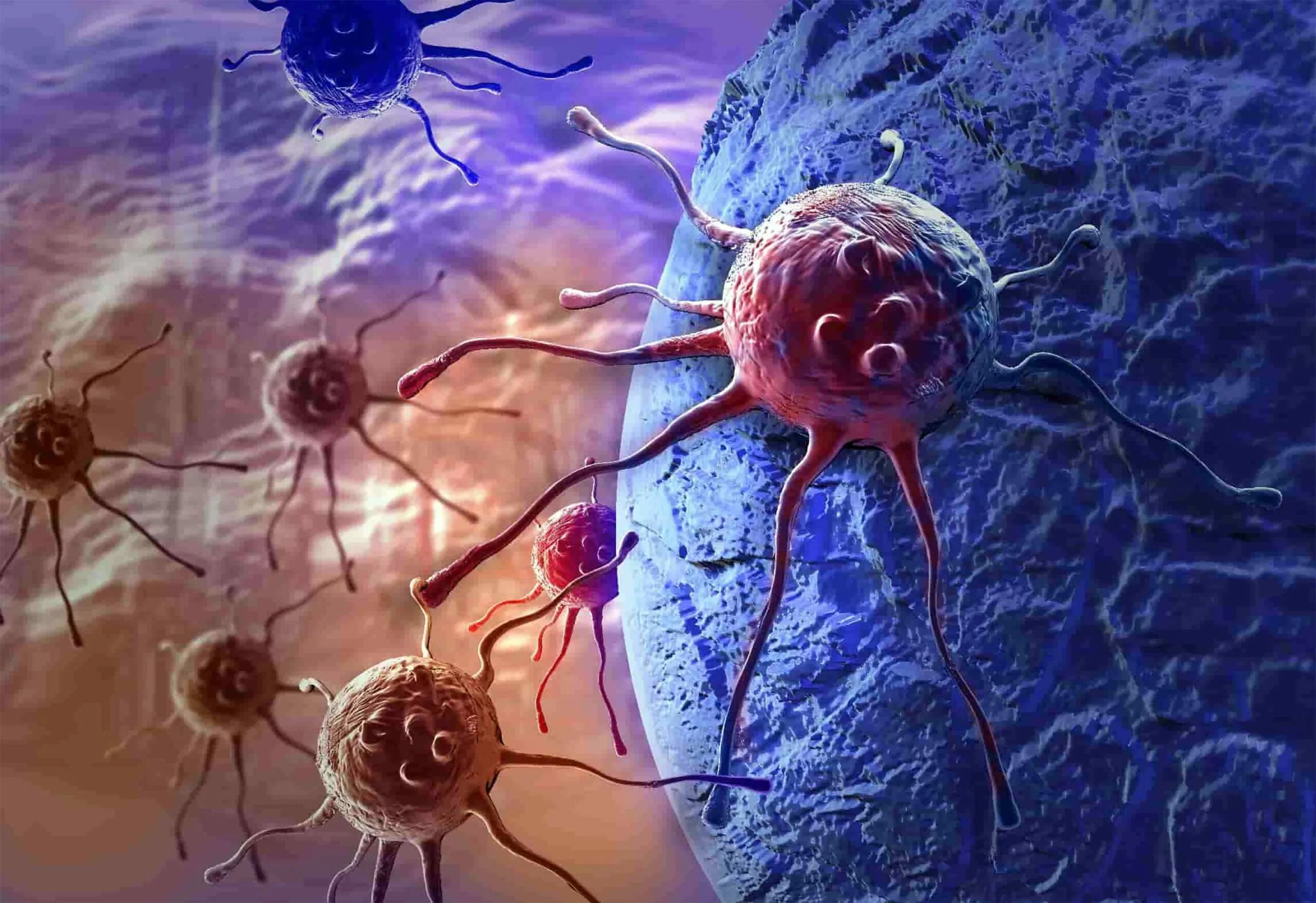Мегакариоцитарный лейкоз. Злокачественные клетки. Злокачественные новообразования. Питание раковой клетки