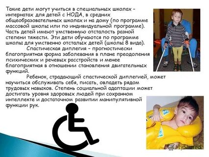 Почему возникает дцп