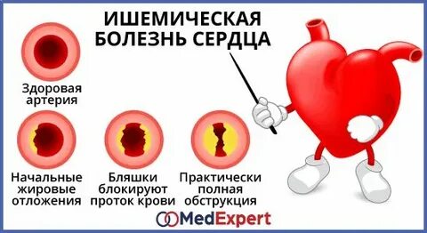 Ишемические поражения сердца