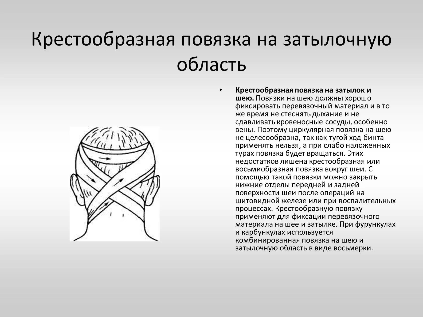 Повреждение затылка какая повязка. Десмургия. Повязка крестообразная на затылок.. Наложение крестообразной повязки на затылок алгоритм. Крестообразная бинтовая повязка. Крестообразная повязка на затылочную на затылок и шею.