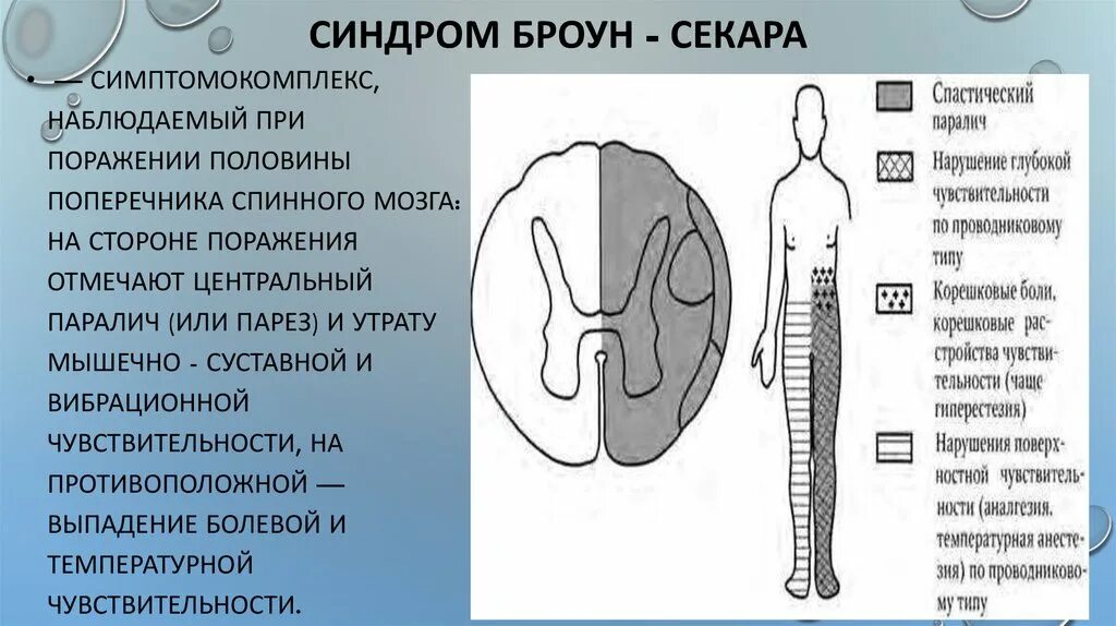 Поражение половины мозга. Поражение половины поперечника спинного мозга. Синдром половинного поражения спинного мозга Броун Секара. Броун Секара очаг поражения. Синдром поражения половины поперечника спинного мозга.