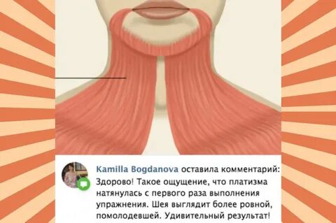 Платизма шеи