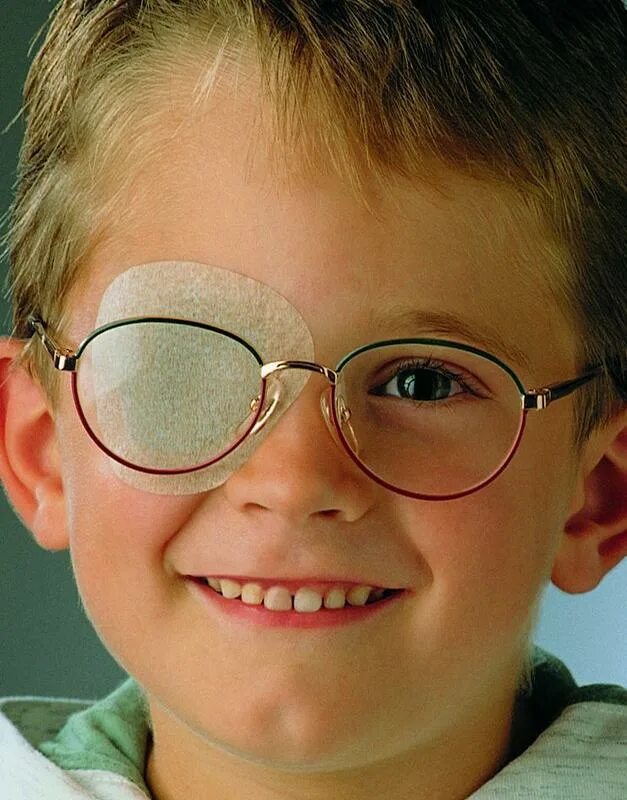 Заклеен глазок. Амблиопия 4 степени. Детские очки для зрения. Очки от косоглазия. Очки для мальчиков.