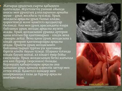 Мүлдем жалаңаш сұлу қыздардың суреттері