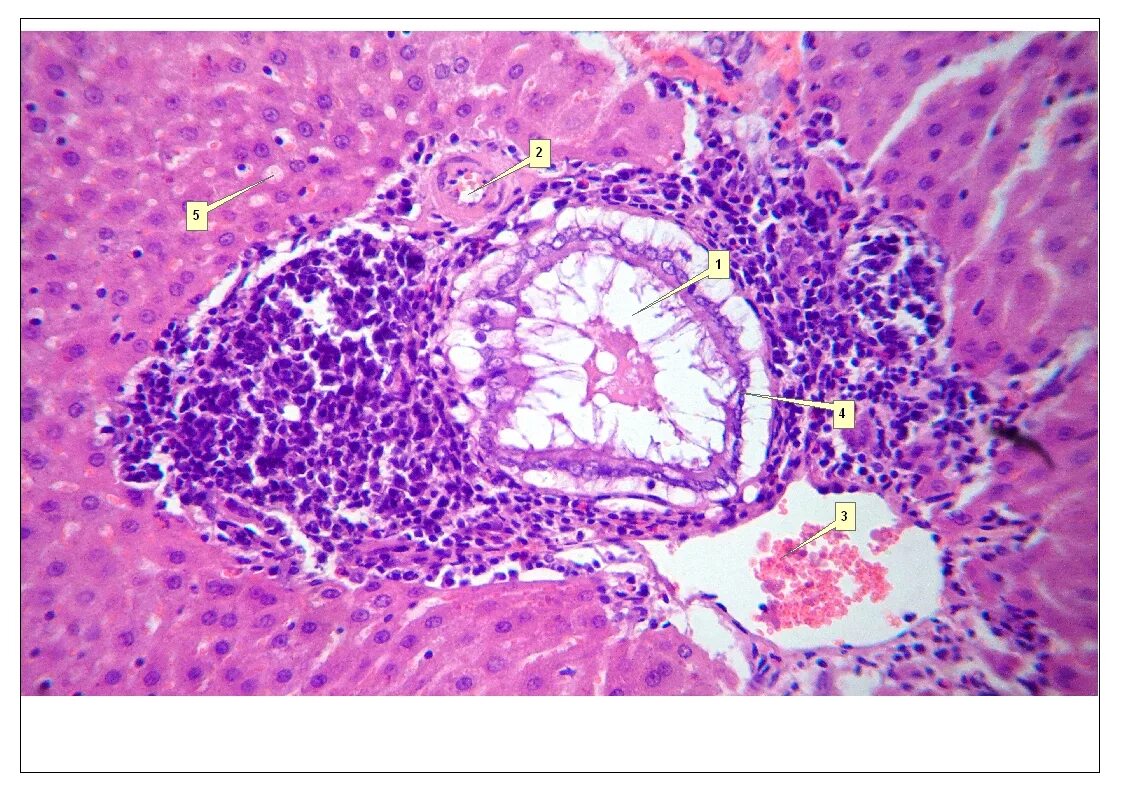 препарат здоровой печени гистология. портальный тракт печени. портальный тракт гистология. портальный тракт печени. воротная вена гистология.