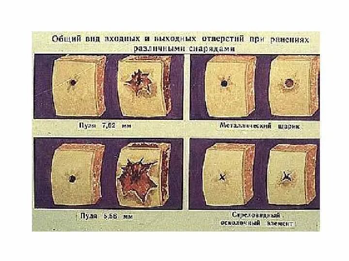 Сквозное огнестрельное ранение. Огнестрельное пулевое ранение. Осколочное огнестрельное ранение. Огнестрельное ранение рана.