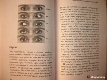 Хорошее зрение без
