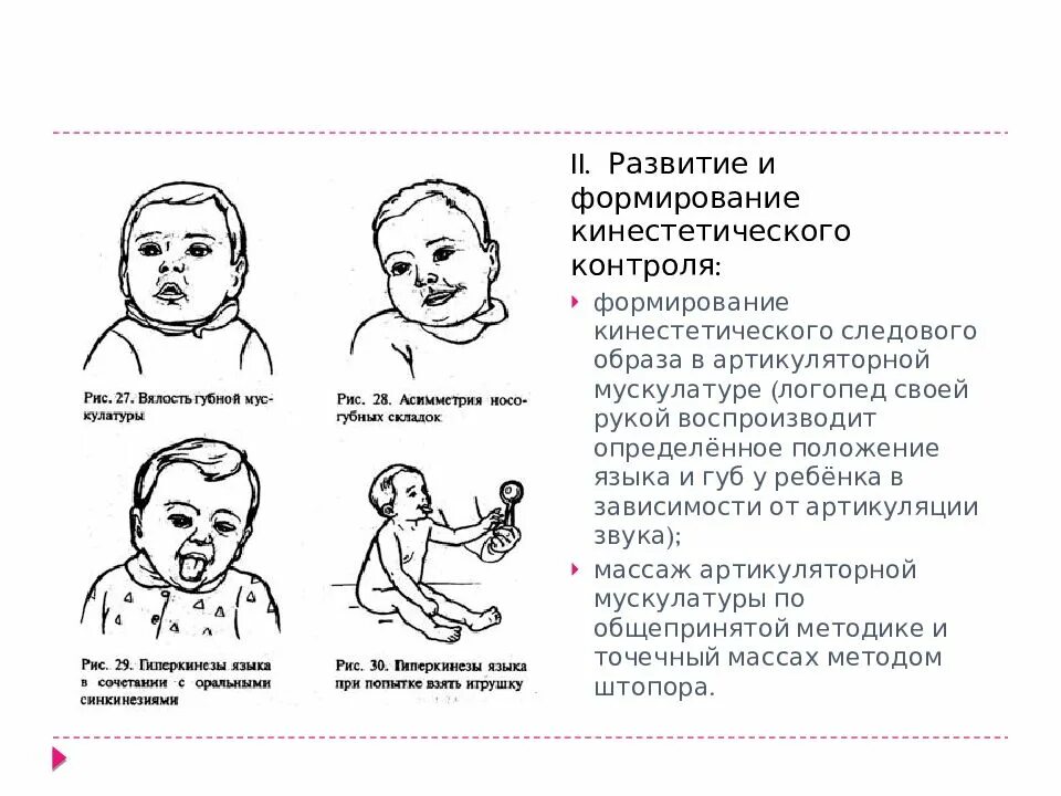 Дцп у новорожденных симптомы. Как определить дцп у грудничка 2 месяца. симптомы дцп у грудничка в 2 месяца. дцп у детей симптомы в 1 год.