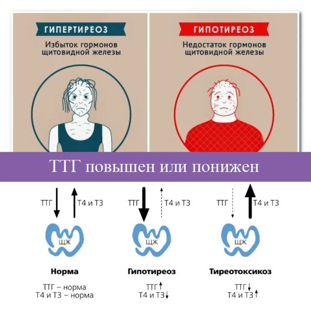 Какие признаки щитовидной железы у женщин. Нормы показателей гормонов щитовидной железы. Показатели гормонов щитовидки при гипотиреозе. ТТГ И т4 гипертиреоз и гипотиреоз. Гормонов щитовидной железы у мужчин ТТГ.