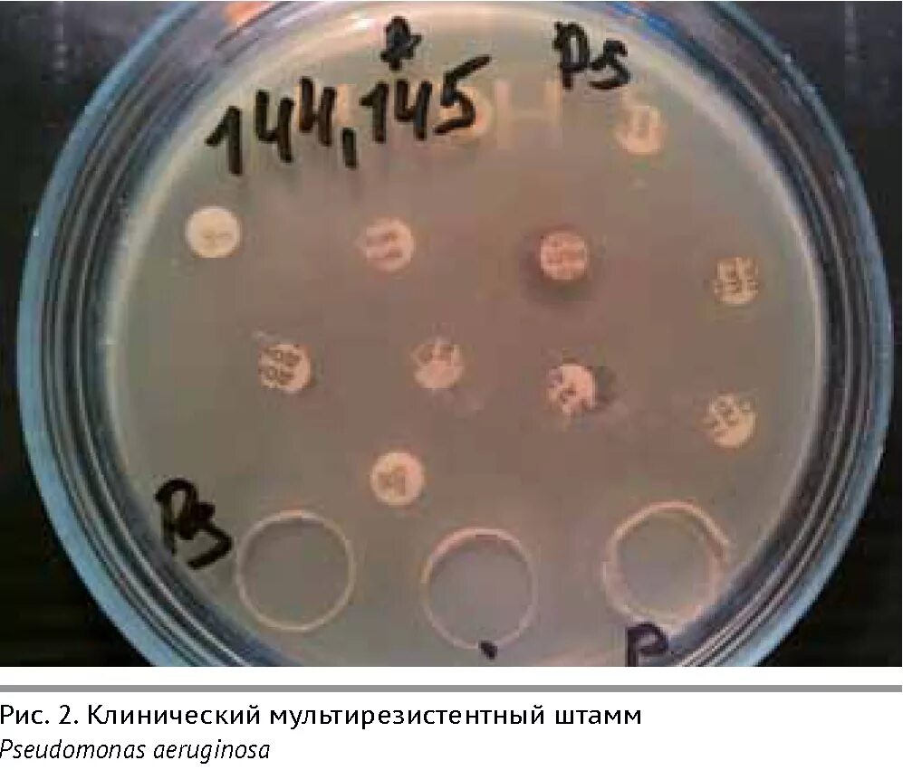 Pseudomonas aeruginosa чувствительность к антибиотикам. Резистентность синегнойной палочки. Госпитальный штамм это. Синегнойная палочка в яйцах куриных.