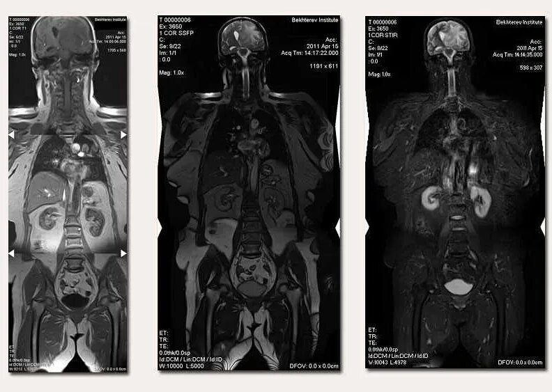 Мрт тела полное цена. Мрт всего тела. Мрт снимки всего тела. Компьютерная томография всего тела. Полное сканирование тела на мрт.