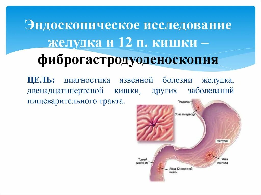 Исследования пищевода и желудка