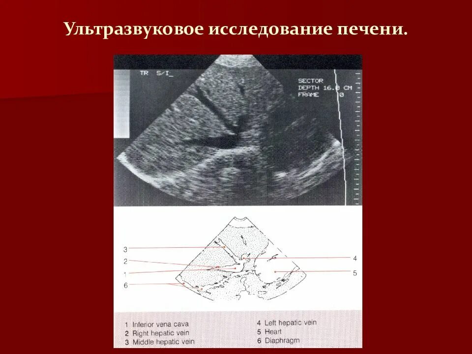 Ультразвуковое исследование печени. Методика осмотра УЗИ печени. Узи печени схема