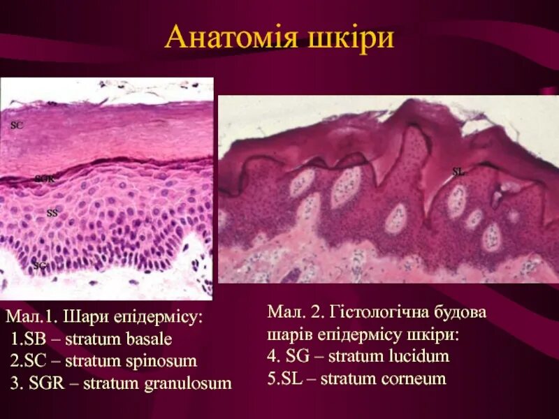 Эритроплазия кейр. Stratum ткань. эритроплазии кейра фото. stratum basale.