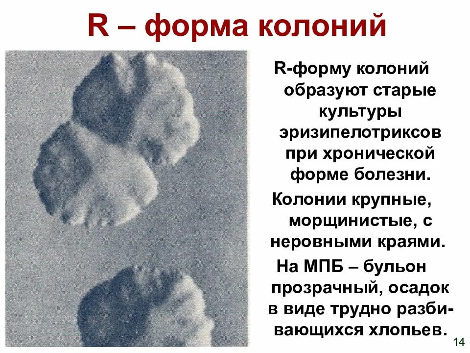 S r формы. С и р формы колоний. формы колоний бактерий r s. r колонии. колонии s и r формы.