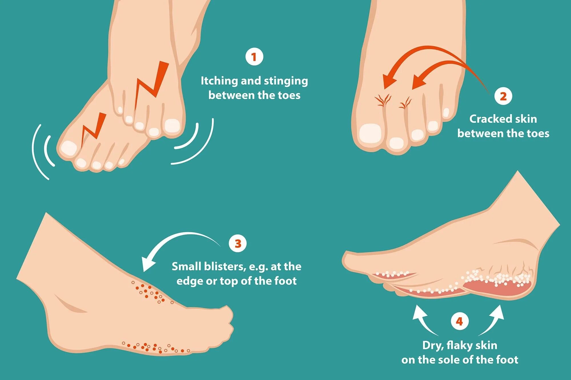 On her toes перевод. Группа big toe. Breathability методика. Flexed foot. Идиомы с keep.
