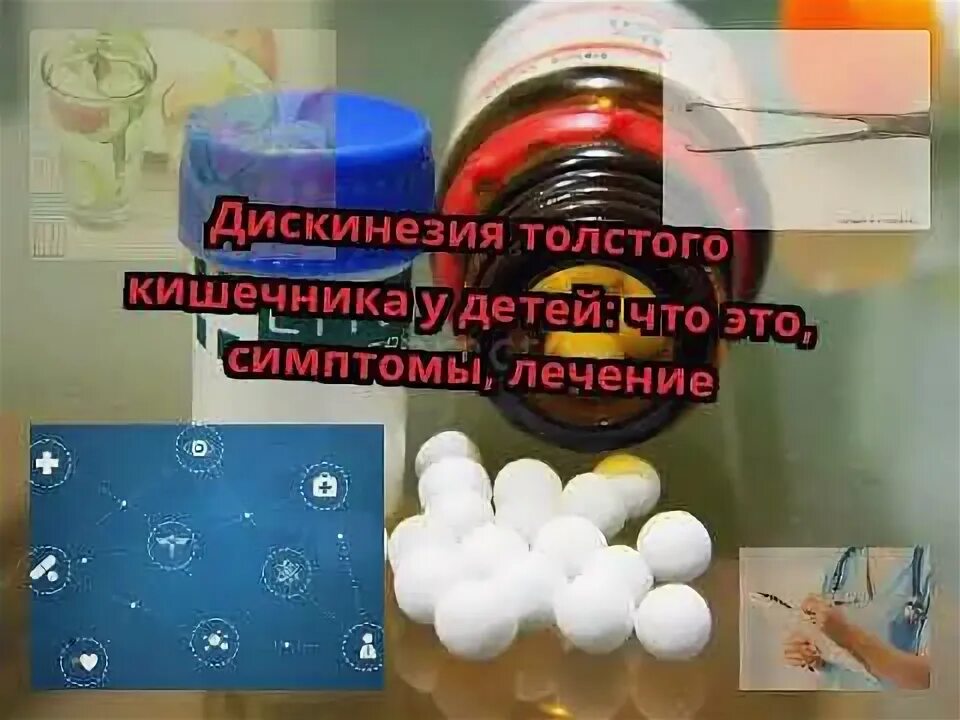 Дискинезия кишечника как лечить. Гипомоторная дискинезия кишечника. гипомоторная дискинезия толстого кишечника. дискинезия толстой кишки по гипомоторному типу. дискинезия толстой кишки по гипотоническому типу.