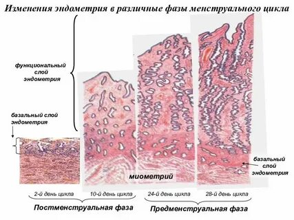 Кровоточит эндометрий