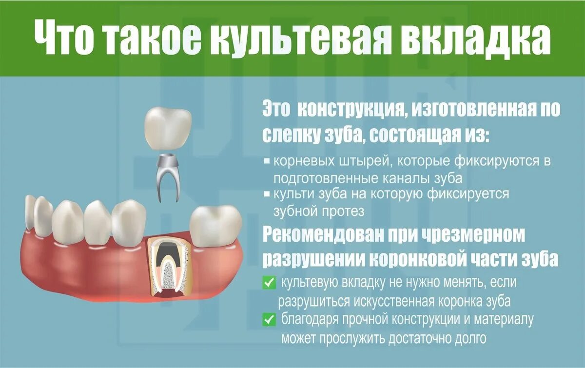 Настройки вкладок. Кнопка закрытия вкладки. Штифтовая культевая вкладка. Составная культевые штифтовые вкладки. Культевые вкладки в стоматологии.