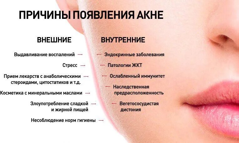 Прыщи на лице какие анализы сдать. Причины появления угревой сыпи. Причины и симптомы угревой сыпи.