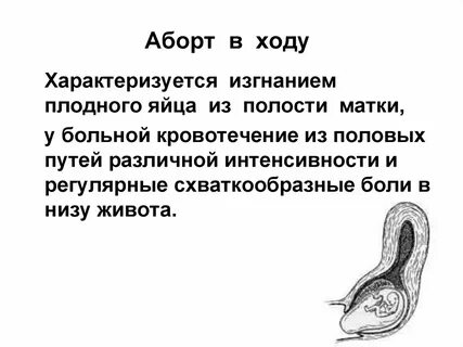 Неполный выкидыш
