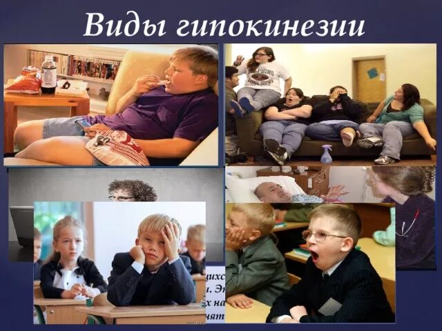 Гиподинамия тест с ответами. Гипокинезия и гиподинамия. последствия гиподинамии фото. профилактика гипокинезии. гиподинамия у детей.
