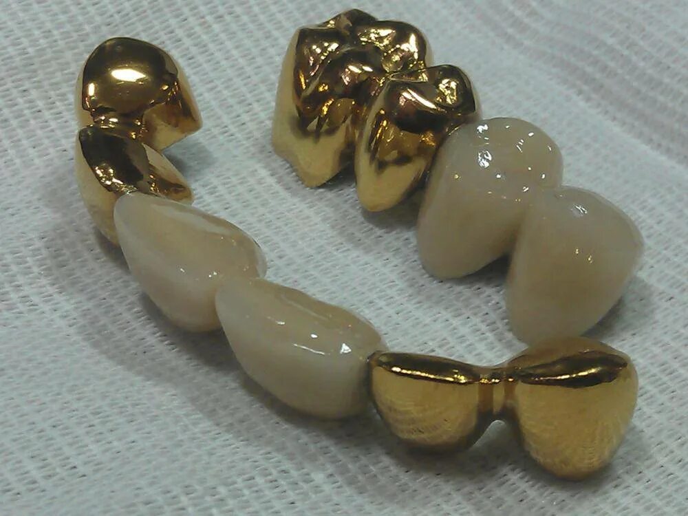 зубные протезы напыление. коронки напыленные цирконием. зубные протезы напыление. зубные протезы напыление. покрытие коронок нитридом титана.