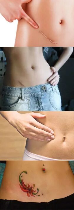 Pin on Appendicitis